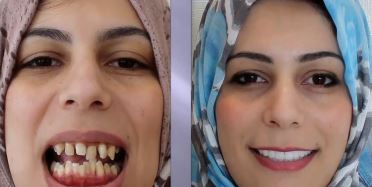 Finance for Cosmetic Dentistry